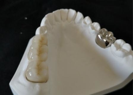 Couronne dentaire de polissage haut Intermiscibility biologique de porcelaine d'OEM