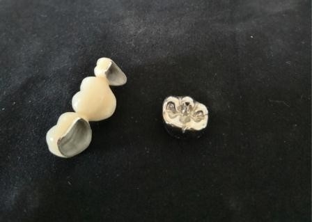 Couronne dentaire de polissage haut Intermiscibility biologique de porcelaine d'OEM
