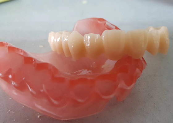 OEM réaliste 3D de données numériques a imprimé les modèles dentaires pour le dentiste Study