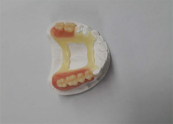 Imprimante dentaire en caoutchouc Dental Laboratory de la couronne 3D du sembler naturel PFM