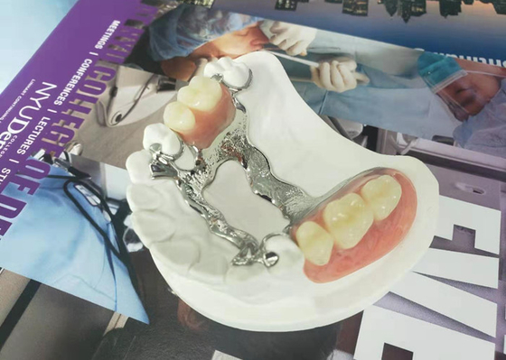 Natrural ombragent 3D imprimant le dentier démontable fixe pour le dentiste Study