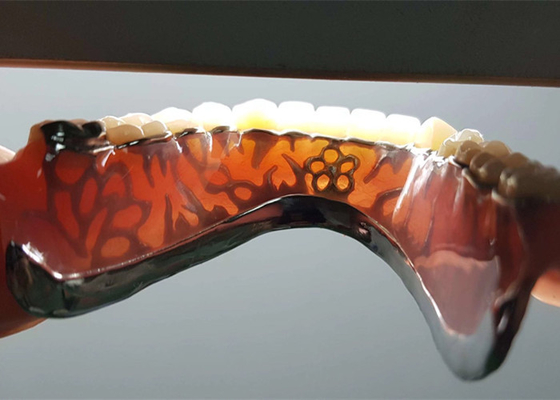 Couronne dentaire démontable d'OEM de sécurité à haute intensité pour le dentiste Study