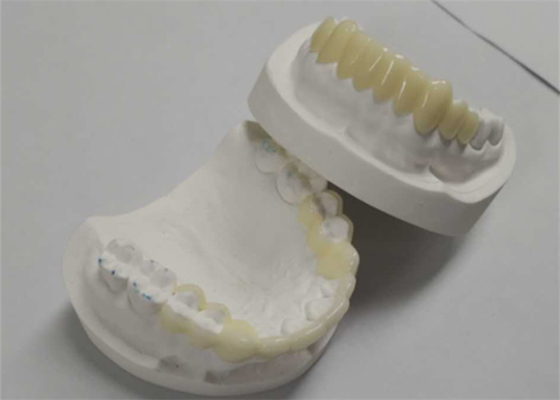 Haute durabilité DAO CAM impression 3D temporaire couronne la résine durable