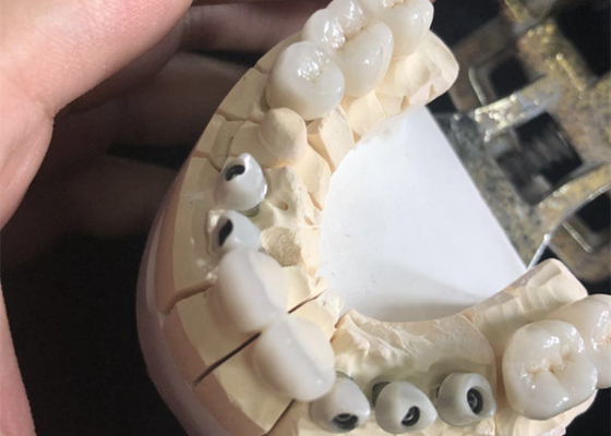 Couronnes dentaires excellent Biocompatibility de zircone blanche libre en métal
