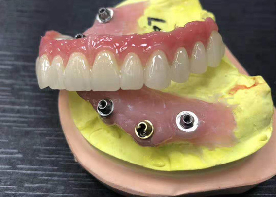 Couronne dentaire de zircone de butée d'implant naturelle tout sur quatre dentiers