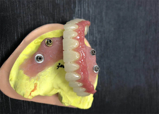 Couronne dentaire de zircone de butée d'implant naturelle tout sur quatre dentiers