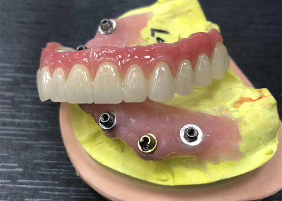 Couronne dentaire de zircone de butée d'implant naturelle tout sur quatre dentiers