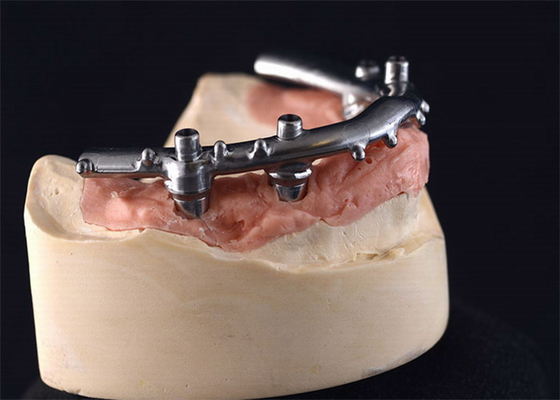 Dureté forte de PFM de dentiers à haute densité d'implants dentaires durable