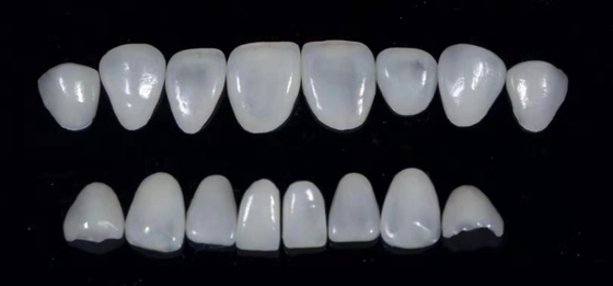 Les placages composés dentaires de Durablity CAD-CAM ont fortement détaillé précis