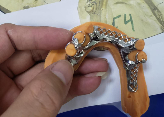 Le pont dentaire flexible en couronne de Digital PFM ultra dur facile maintiennent