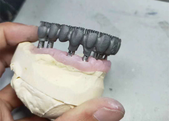Imprimante durable Dental Lab Prints du DAO FAO PFM 3D pour la recherche