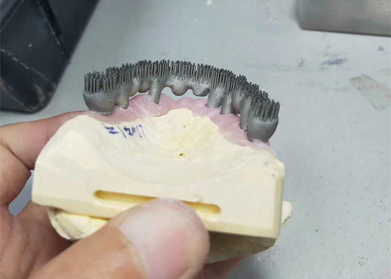 Imprimante durable Dental Lab Prints du DAO FAO PFM 3D pour la recherche