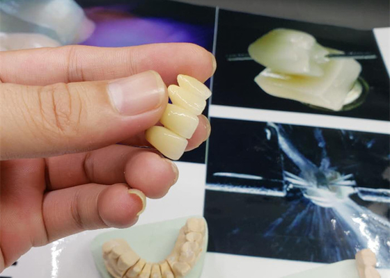 Couronne anticorrosion de porcelaine d'OEM de sécurité tout le regard naturel en céramique