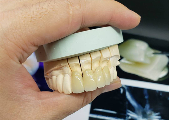 Couronne anticorrosion de porcelaine d'OEM de sécurité tout le regard naturel en céramique
