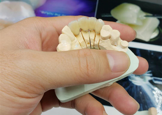 Couronne anticorrosion de porcelaine d'OEM de sécurité tout le regard naturel en céramique
