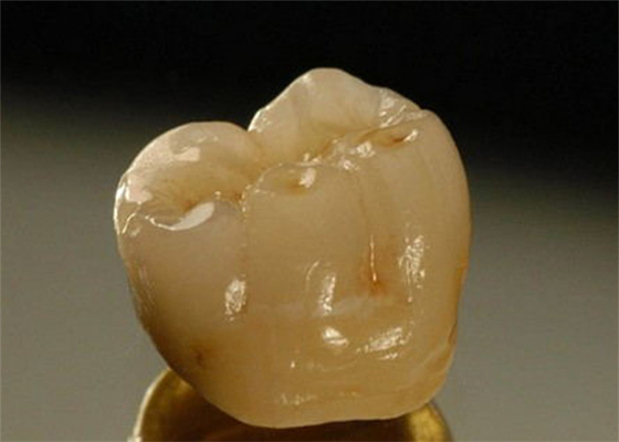 Couronne dentaire de porcelaine inter de miscibilité