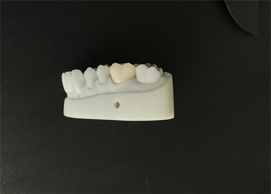 OEM 3D a imprimé la conception dentaire du DAO FAO de modèles pour le laboratoire de dentier