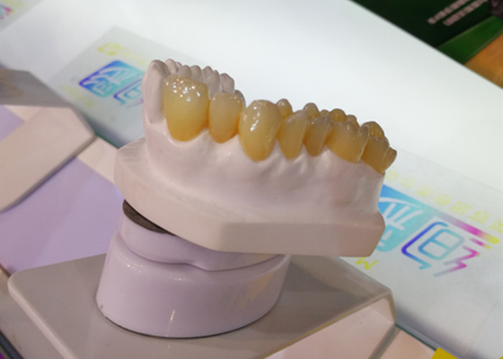 Imprimante dentaire Dental Crowns du laboratoire 3D de couronne de la conception PFM du DAO FAO