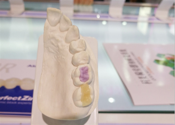 Couronne Tout-en céramique de FDA de céramique dentaire faite sur commande à haute densité faite sur commande