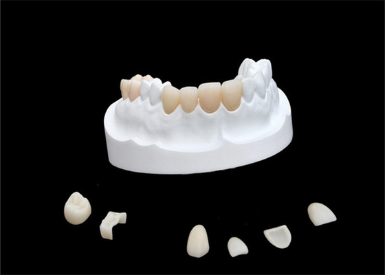 Placages composés de porcelaine d'IPS E Max Ceramic Dental Crown Comfortable
