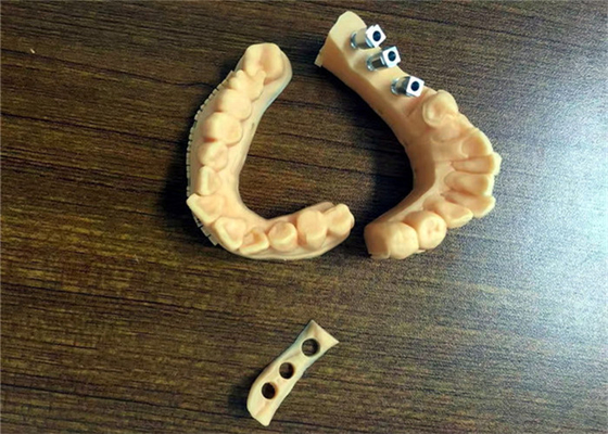 FDA 3D a imprimé la porcelaine dentaire de couronne de modèles dentaires fondue au métal