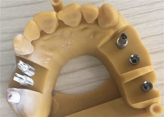 Couronne dentaire 3D de Digital Biocompatibility PFM imprimant les couronnes provisoires