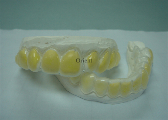 Les appareils orthodontiques de FDA sont anticorrosion et durables