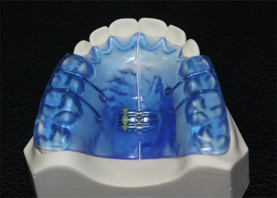Instruments dentaires orthopédiques avec Biocompatibility de forte stabilité et bon