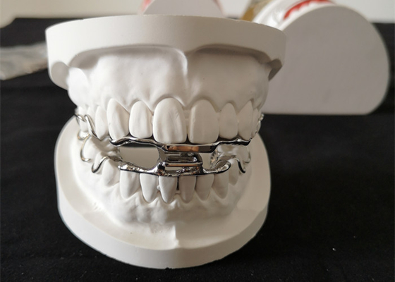 Conception de haute résistance des appareils orthodontiques dentaires 3D Digital d'OEM
