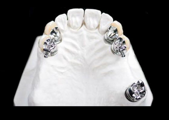 Le dentier partiel d'OEM d'attachement propre facile de précision souillent résistant