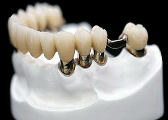 Résistance à la corrosion de dentier d'attachement de précision du CR MK1 de Co