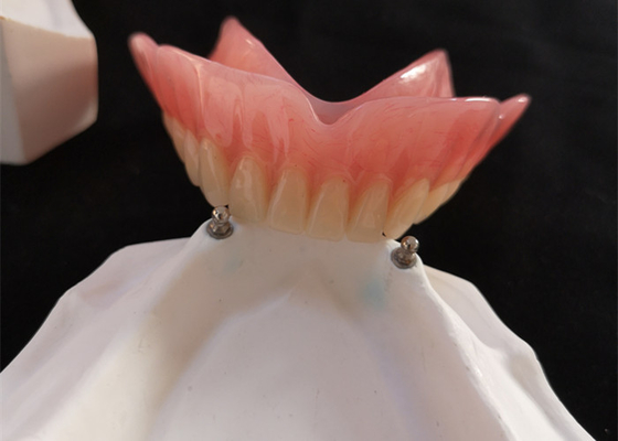 Haut implant du dentier CAD-CAM d'attachement de précision de Biocompatibility