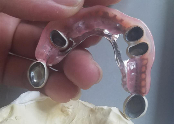 Dentier durable flexible d'attachement de précision anticorrosion