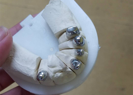 Dentier durable flexible d'attachement de précision anticorrosion