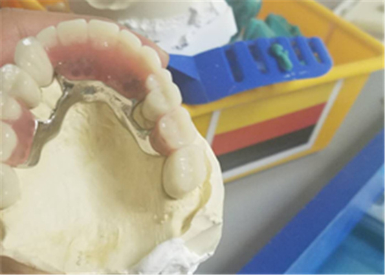 Dentier durable flexible d'attachement de précision anticorrosion