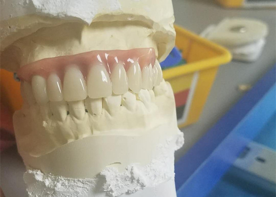 Dentier durable flexible d'attachement de précision anticorrosion
