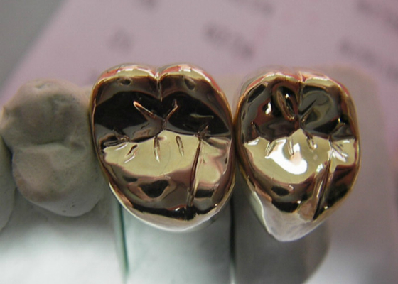 Couronne de haute résistance de métal précieux semi de dent de couronne en métal de FMC