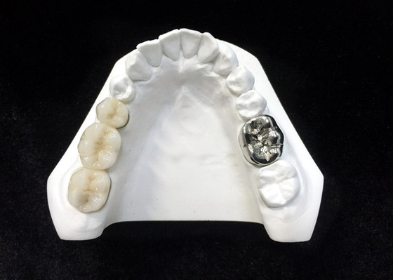 Haute densité dentaire de sécurité de santé de couronne de porcelaine ultra dure de Digital