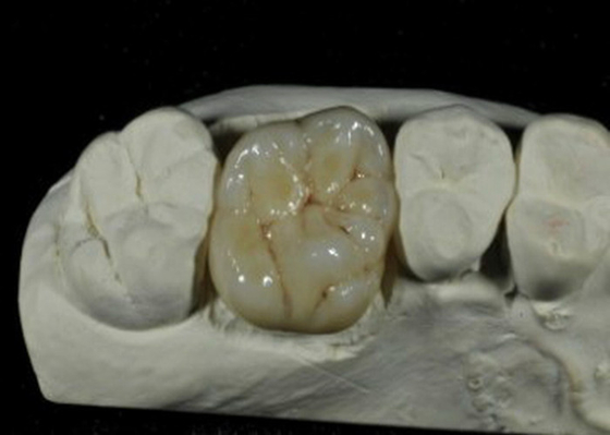 Couronne dentaire de porcelaine flexible d'OIN de la CE pour la restauration de dents arrières
