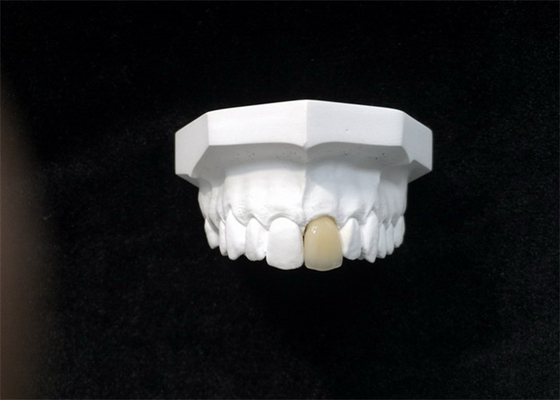 Matériel biologique de Technologie de pointe de bonne de Biocompatibility couronne dentaire de porcelaine