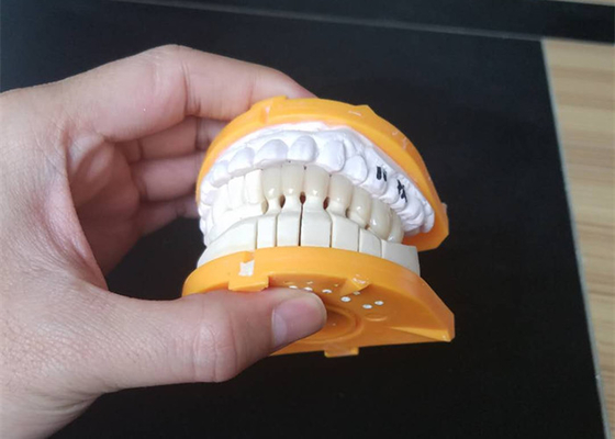 Couronnes en céramique faites sur commande de la taille PFM pour les dents postérieures et antérieures