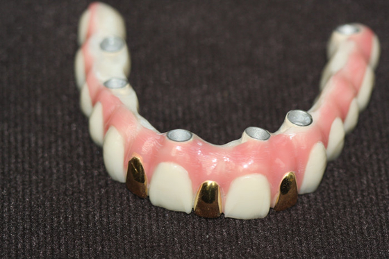 Précision Digital 3D imprimant le métal de barre d'implant dentaire basé