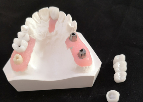 Bonne barre inter biologique d'implant dentaire de miscibilité avec l'approbation de FDA