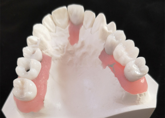 Bonne barre inter biologique d'implant dentaire de miscibilité avec l'approbation de FDA