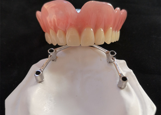 Implants dentaires de FDA de couronne d'implant de dent de COCR avec la barre titanique