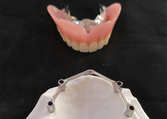 Implants dentaires de FDA de couronne d'implant de dent de COCR avec la barre titanique