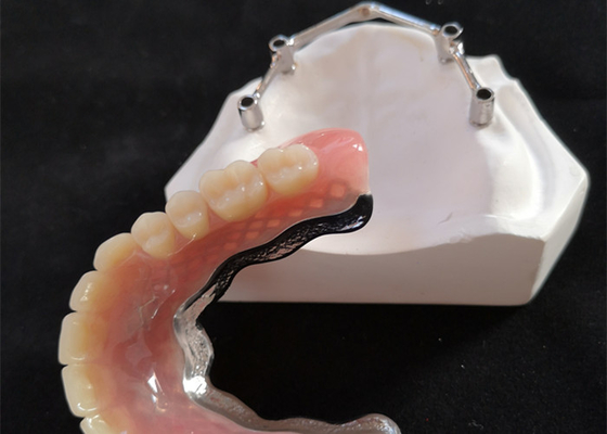 Barre d'implant dentaire en titane/titane pur pour le centre numérique CAD CAM