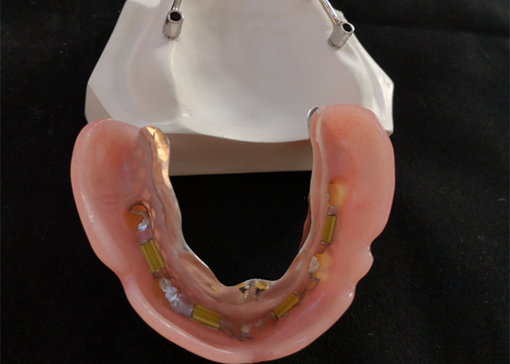 Barre d'implant dentaire en titane/titane pur pour le centre numérique CAD CAM
