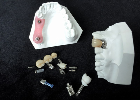 Dentier de forte stabilité d'attachement de barre de repères faits sur commande d'implant dentaire