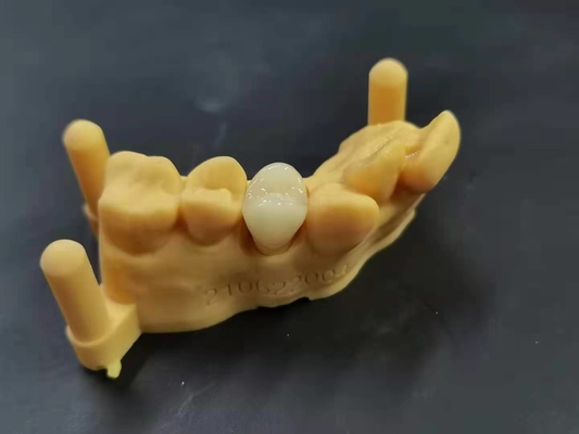 OEM 3D imprimant la conception dentaire de Digital de laboratoire de dentier acrylique flexible